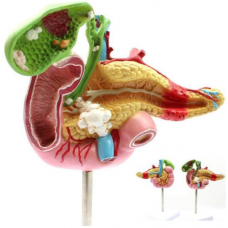 Pancreas, Duodenum and Gallbladder Pathological Model